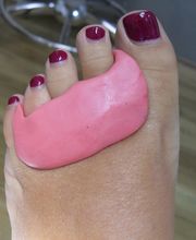 CENTRO DE PODOLOGIA AVANZADA DEL BOZ Y RODRIGUEZ SL imagen 14