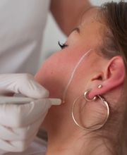 Dauerhafte Haarentfernung - Remove Laserzentrum Stuttgart Bild 9