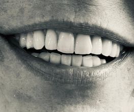 DentalLook Sagl Bild 4