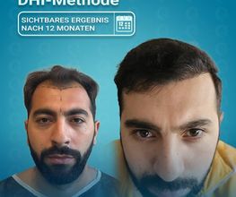MedHair Clinic | Haartransplantationen in der Türkei Istanbul Bild 7