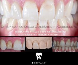 Dentalp SA Bild 7