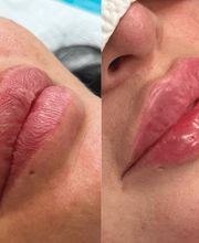 Beautyexperience Lejla GmbH Bild 3