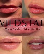 WildState Lawton image 2