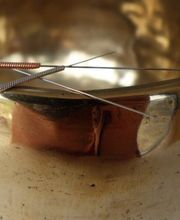 Praxis für TCM und Akupunktur - Martina Hack Bild 3