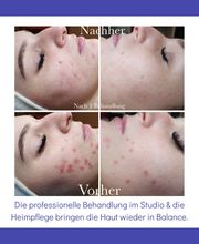 Beautyflash by Andrea Canini Bild 4