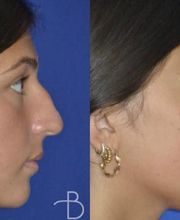 Agata Brys, MD Facial Plastic Surgery image 5