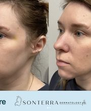 Sonterra Dermatology at The Pearl image 2