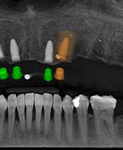 Draper Dental image 6