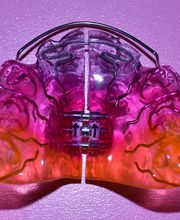 Dental Design ILG Bild 3