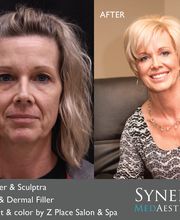 Synergy MedAesthetics image 4