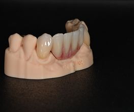 ModeLab Dental Bild 16