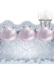 Lignon Esthétique - Institut de Beauté Bild 4