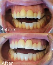 Barlow Family Dentistry image 6