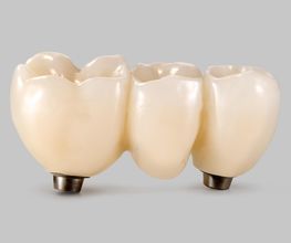 CeraLab - Das digitale Dentallabor Bild 6