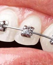 Isabel Perales Clínica Dental imagen 1