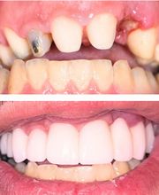 Great Neck Dental Arts image 10