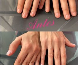 esteticacristallogono3.JPG