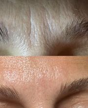 Wrinkle Free WA image 5