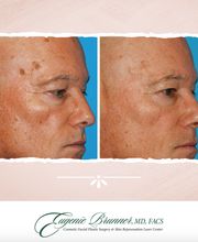 Eugenie Brunner, MD, FACS image 7