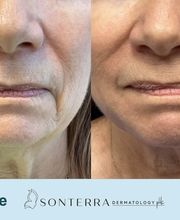 Sonterra Dermatology image 19
