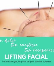 pm-acupuntura imagen 7