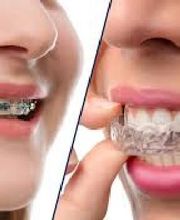 Clínica Dental Vitaldent imagen 6