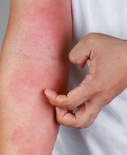 Radiant Dermatology & Aesthetics - Spring image 19