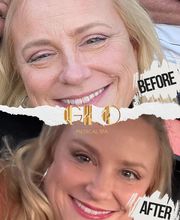 Get Up and Glo Medspa image 2