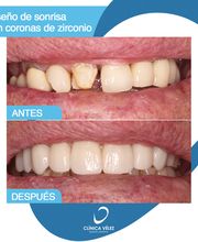 Clinica-demtal-y-Estetica-Velez-5.png