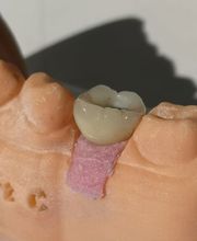 Zahnarzt Dr. med. dent. Franck R. Tolen Bild 6