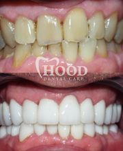 Hood Dental Care - Watson Office image 2