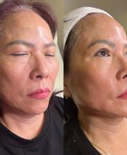 PÜR LIFE Medical - Austin image 1