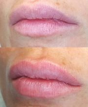 Permanent Make Up Lippen