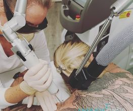 ENDLICH OHNE Tattooentfernung Filiale Brandenburg Bild 14