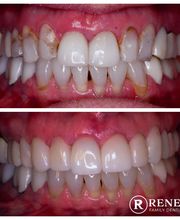 Renew Family Dentistry image 10