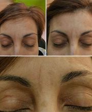 Royal Depil India imagen 12