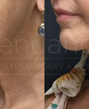 Renuance Cosmetic Surgery and MedSpa image 16