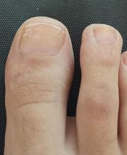 Podología clínica y deportiva Sureste imagen 8