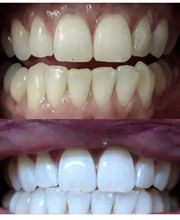 Get Up and Glo Medspa image 12