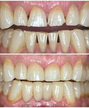 Affinity Smiles image 10