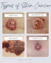 North Metro Dermatology image 5