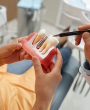 Albayzín Dental imagen 11