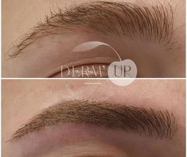 DERM UP image 6