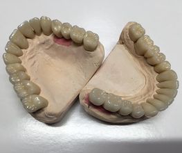 Dentaltechnik Oriwal Bild 4