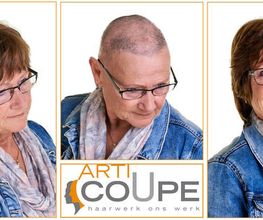 Alopecia Totalis