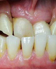 Clínica Implanteoral Milladoiro imagen 9