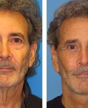 Stephen Bresnick MD image 2