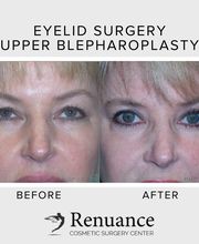 Renuance Cosmetic Surgery and MedSpa image 1