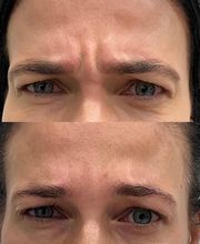 Juvenalia Brío | Botox, Hydrafacial & Ultraformer - Condesa / Roma Norte CDMX imagen 7
