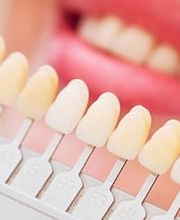 Zahnarztpraxis Dr. Peter und Katrin Bastobbe Bild 8